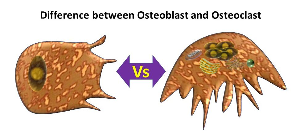 Difference between Osteoblast and Osteoclast