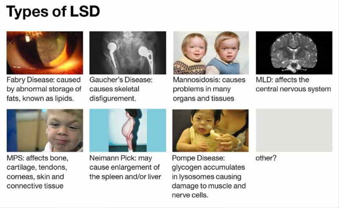 The Lysosomal Storage Disorders (LSD)